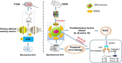 Neuroinflammation Involved in Diabetes-Related Pain and Itch